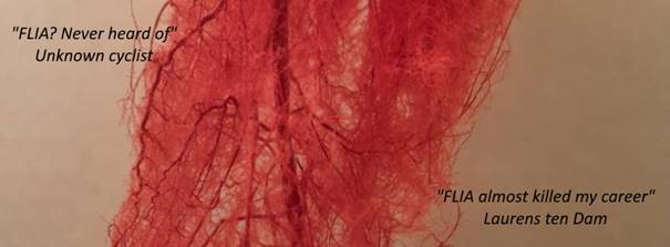 FLIA Flow Limitations in the Iliac Artery